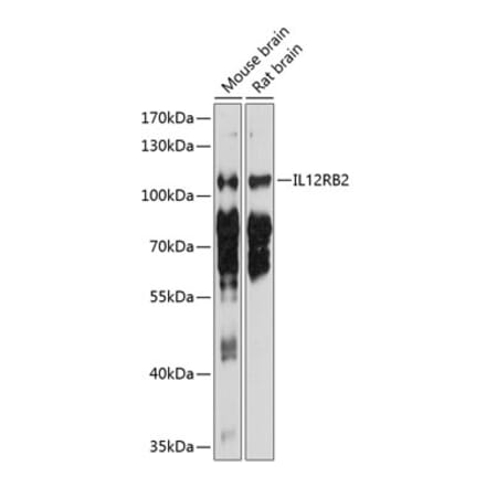 Western Blot - Anti-IL-12RB2 Antibody (A17162) - Antibodies.com