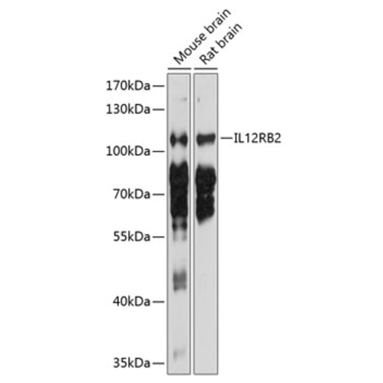 Western Blot - Anti-IL-12RB2 Antibody (A17162) - Antibodies.com