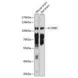 Western Blot - Anti-IL-12RB2 Antibody (A17162) - Antibodies.com