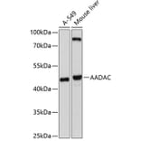 Western Blot - Anti-AADAC/DAC Antibody (A17163) - Antibodies.com