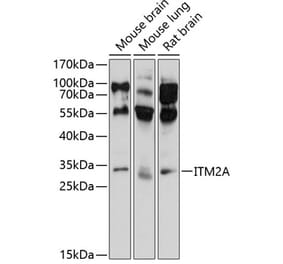 Western Blot - Anti-ITM2A Antibody (A17164) - Antibodies.com