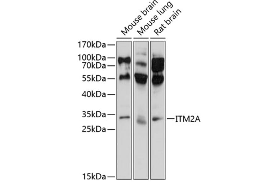 Western Blot - Anti-ITM2A Antibody (A17164) - Antibodies.com