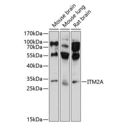 Western Blot - Anti-ITM2A Antibody (A17164) - Antibodies.com