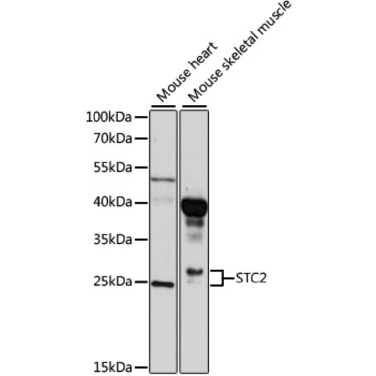 Western Blot - Anti-STC2 Antibody (A10397) - Antibodies.com