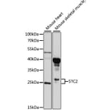 Western Blot - Anti-STC2 Antibody (A10397) - Antibodies.com