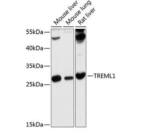 Western Blot - Anti-TLT-1 Antibody (A17166) - Antibodies.com