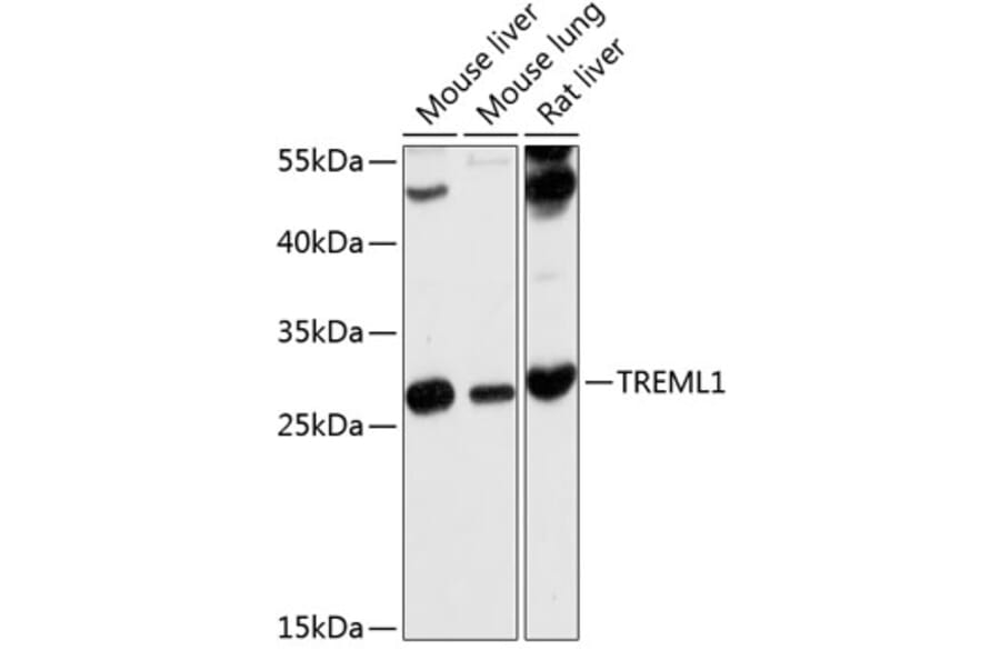 Western Blot - Anti-TLT-1 Antibody (A17166) - Antibodies.com