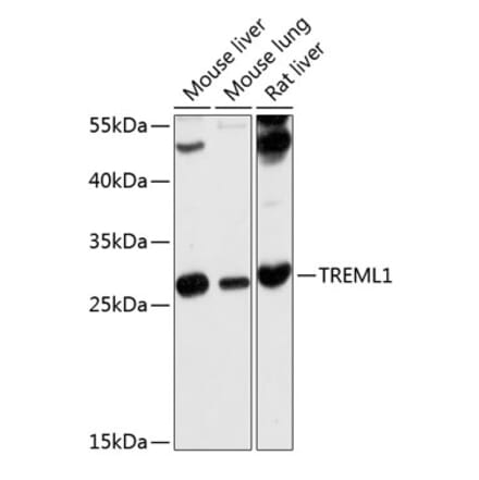 Western Blot - Anti-TLT-1 Antibody (A17166) - Antibodies.com