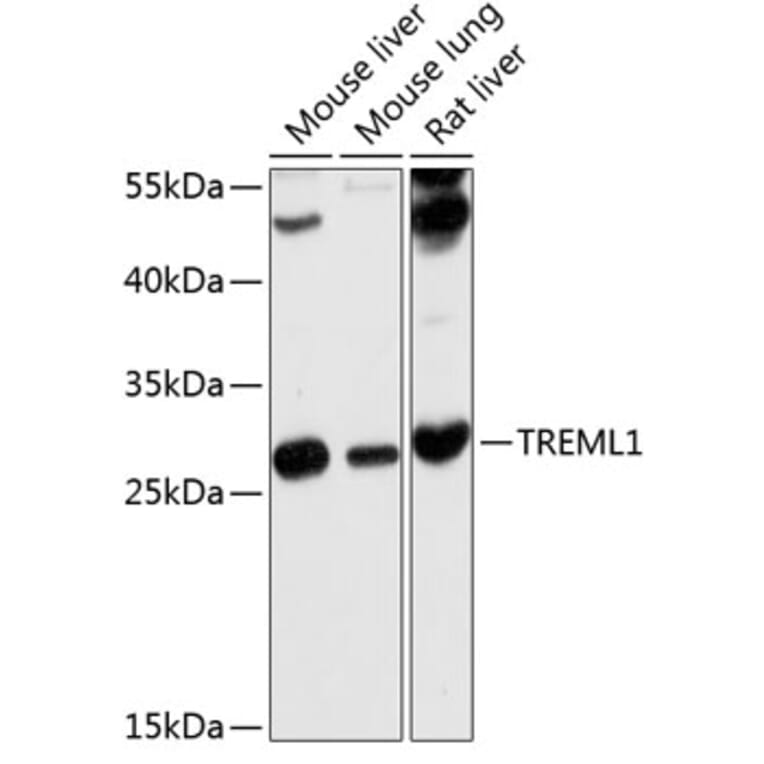 Western Blot - Anti-TLT-1 Antibody (A17166) - Antibodies.com