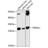 Western Blot - Anti-TLT-1 Antibody (A17166) - Antibodies.com