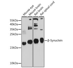 Western Blot - Anti-beta Synuclein Antibody (A17167) - Antibodies.com