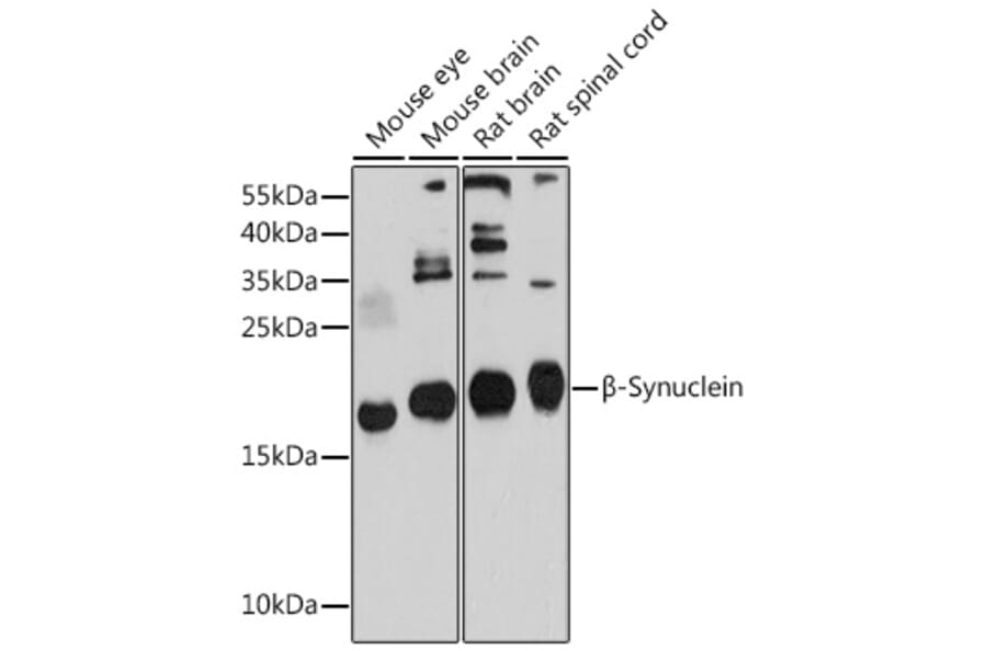 Western Blot - Anti-beta Synuclein Antibody (A17167) - Antibodies.com