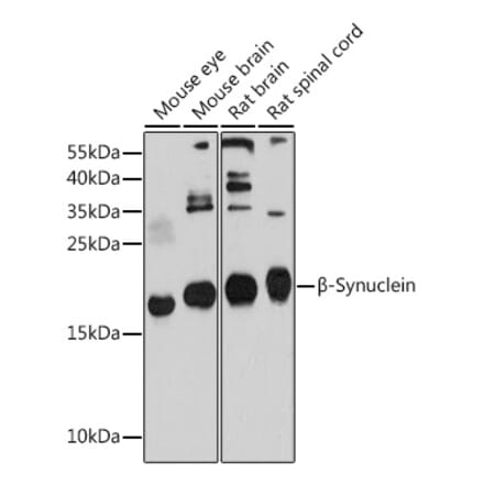 Western Blot - Anti-beta Synuclein Antibody (A17167) - Antibodies.com