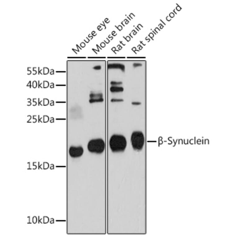 Western Blot - Anti-beta Synuclein Antibody (A17167) - Antibodies.com