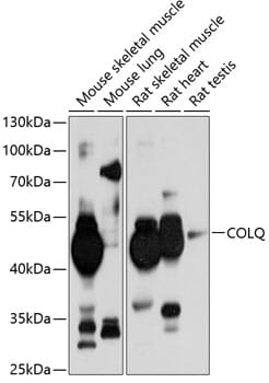 Western blot analysis of extracts of various cell lines, using Anti-COLQ Antibody (A10448) at 1:1,000 dilution.
Secondary antibody: Goat Anti-Rabbit IgG (H+L) (HRP) (AS014) at 1:10,000 dilution.
Lysates / proteins: 25µg per lane.
Blocking buffer: 3% non-fat dry milk in TBST.
Detection: ECL Basic Kit (RM00020).
Exposure time: 15s.