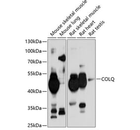 Western Blot - Anti-COLQ Antibody (A17168) - Antibodies.com