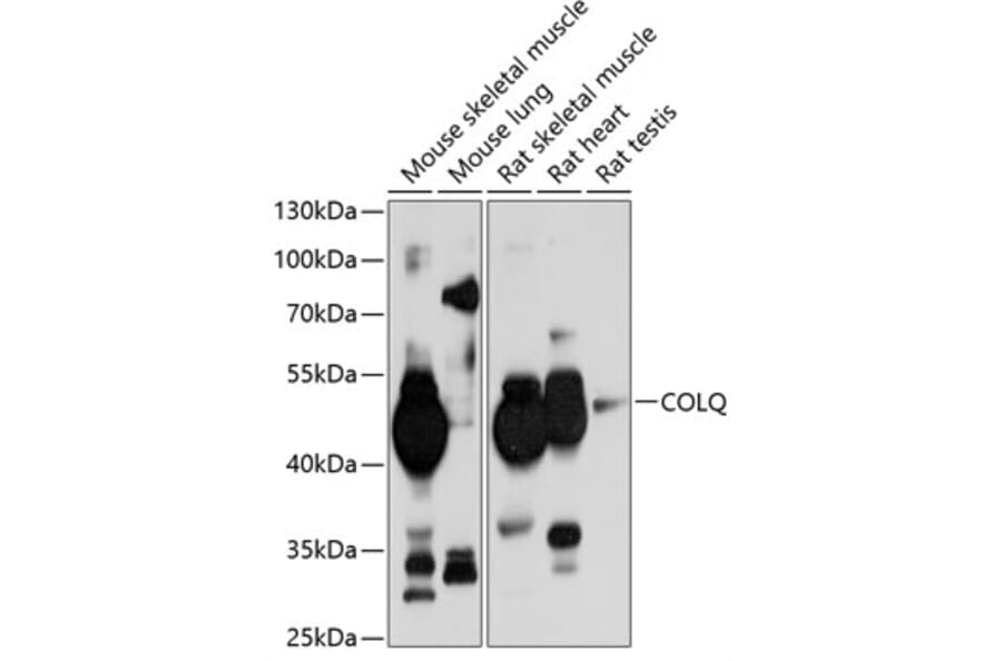 Western Blot - Anti-COLQ Antibody (A17168) - Antibodies.com