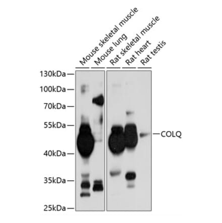 Western Blot - Anti-COLQ Antibody (A17168) - Antibodies.com
