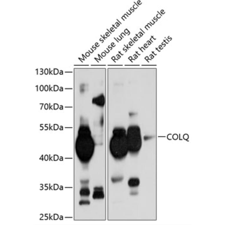Western Blot - Anti-COLQ Antibody (A17168) - Antibodies.com