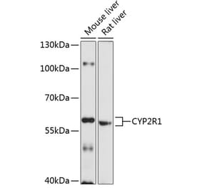 Western Blot - Anti-CYP2R1 Antibody (A17169) - Antibodies.com