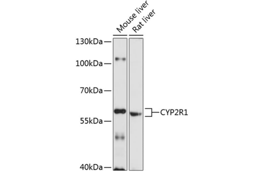 Western Blot - Anti-CYP2R1 Antibody (A17169) - Antibodies.com