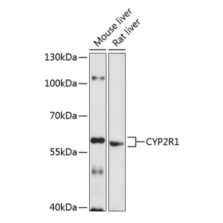 Western Blot - Anti-CYP2R1 Antibody (A17169) - Antibodies.com