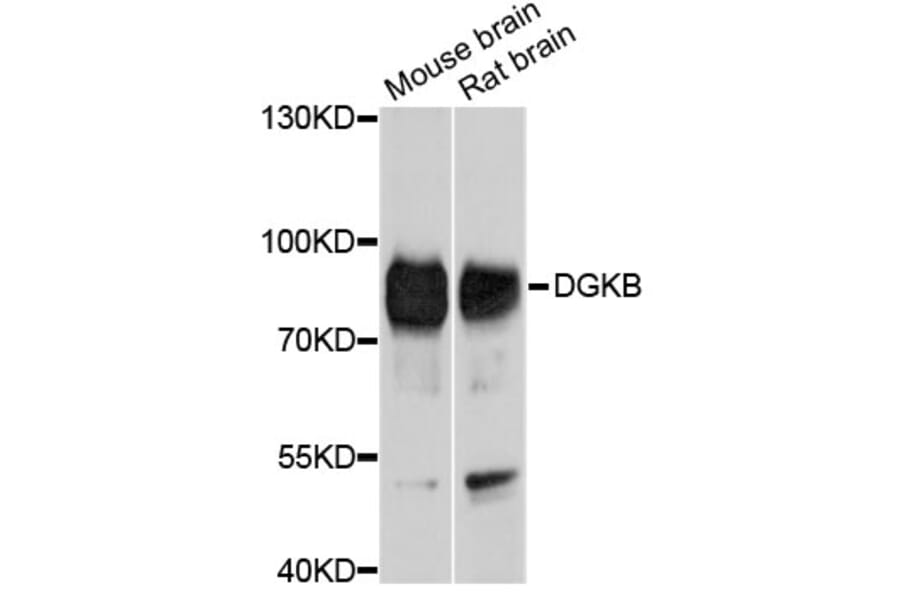 Western Blot - Anti-DGKB Antibody (A10534) - Antibodies.com