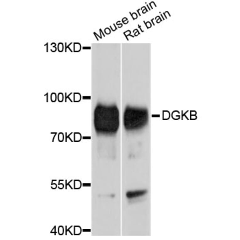 Western Blot - Anti-DGKB Antibody (A10534) - Antibodies.com
