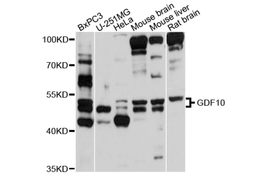 Western Blot - Anti-GDF10 Antibody (A10560) - Antibodies.com