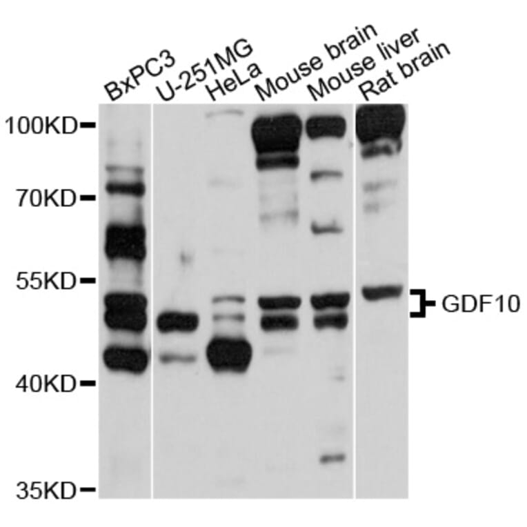 Western Blot - Anti-GDF10 Antibody (A10560) - Antibodies.com