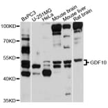 Western Blot - Anti-GDF10 Antibody (A10560) - Antibodies.com