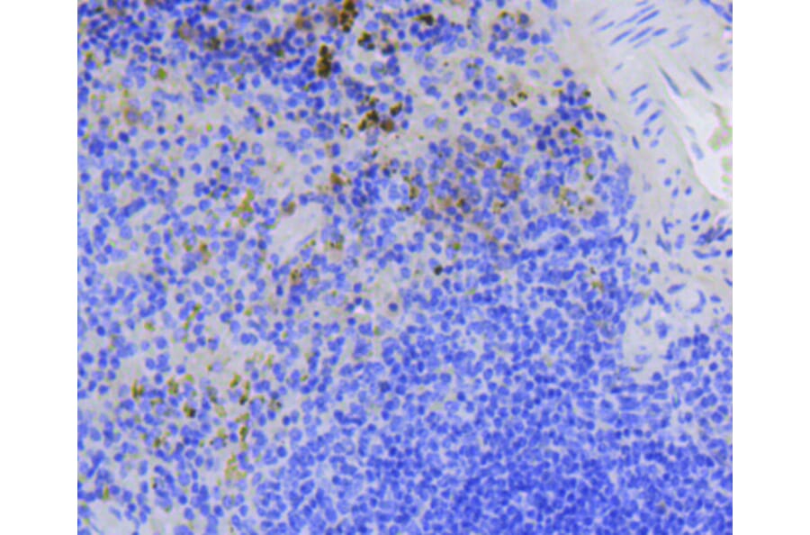 Immunohistochemistry - Anti-BIRC5 Antibody (A10738) - Antibodies.com