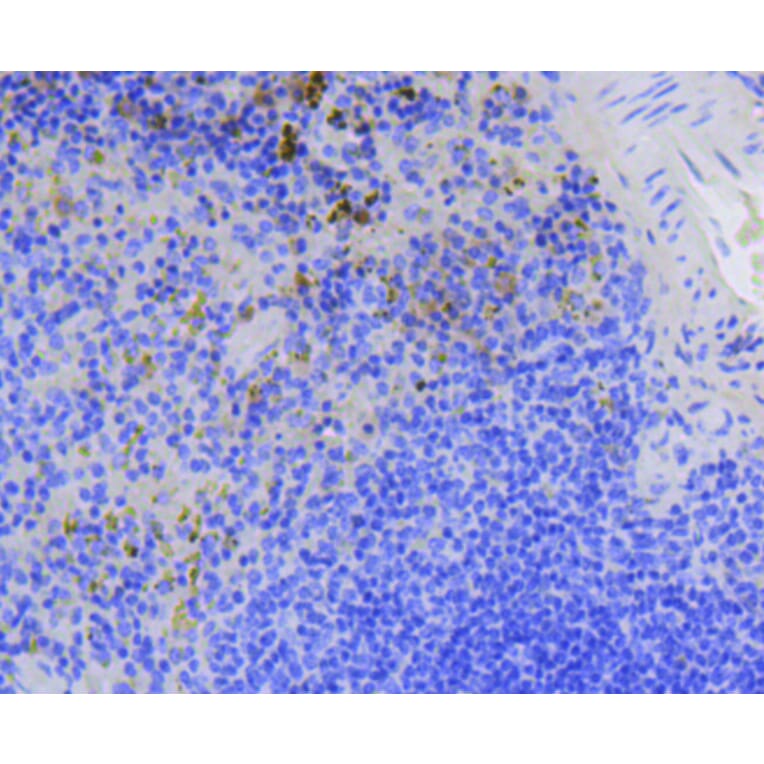 Immunohistochemistry - Anti-BIRC5 Antibody (A10738) - Antibodies.com