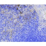 Immunohistochemistry - Anti-BIRC5 Antibody (A10738) - Antibodies.com