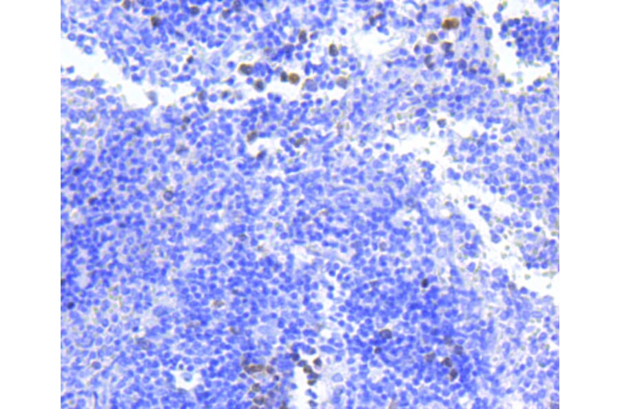 Immunohistochemistry - Anti-BIRC5 Antibody (A10738) - Antibodies.com