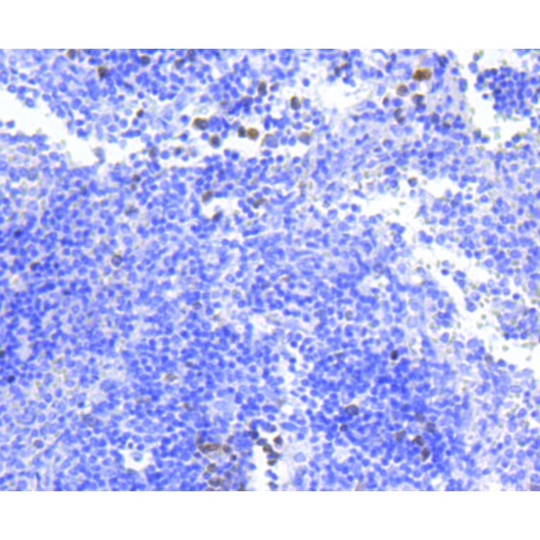 Immunohistochemistry - Anti-BIRC5 Antibody (A10738) - Antibodies.com