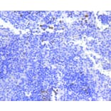 Immunohistochemistry - Anti-BIRC5 Antibody (A10738) - Antibodies.com