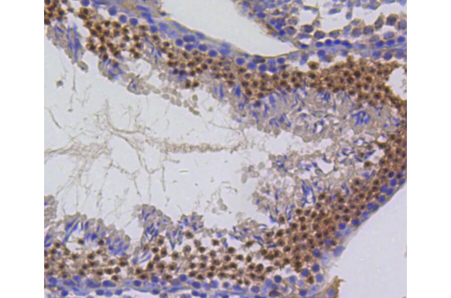 Immunohistochemistry - Anti-BIRC5 Antibody (A10738) - Antibodies.com