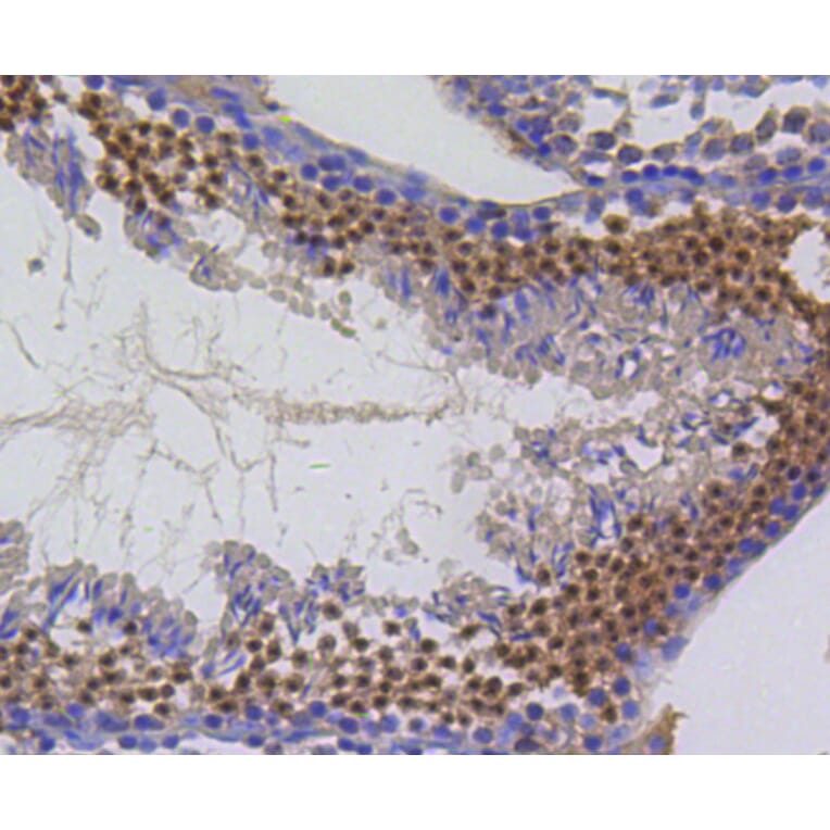 Immunohistochemistry - Anti-BIRC5 Antibody (A10738) - Antibodies.com
