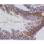 Immunohistochemistry - Anti-BIRC5 Antibody (A10738) - Antibodies.com