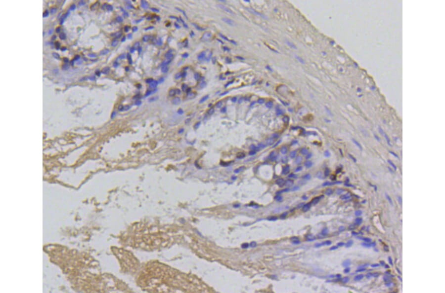 Immunohistochemistry - Anti-BIRC5 Antibody (A10738) - Antibodies.com
