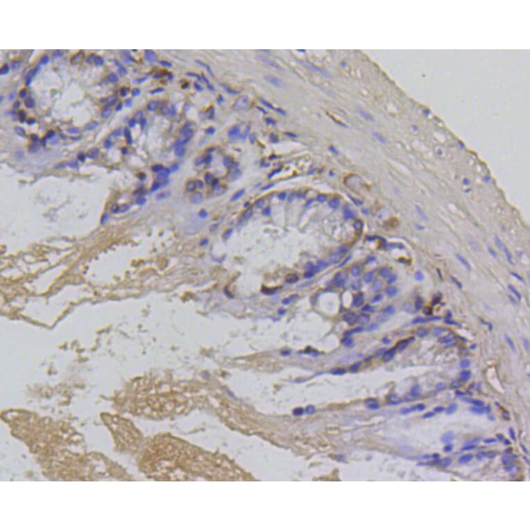 Immunohistochemistry - Anti-BIRC5 Antibody (A10738) - Antibodies.com