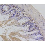 Immunohistochemistry - Anti-BIRC5 Antibody (A10738) - Antibodies.com