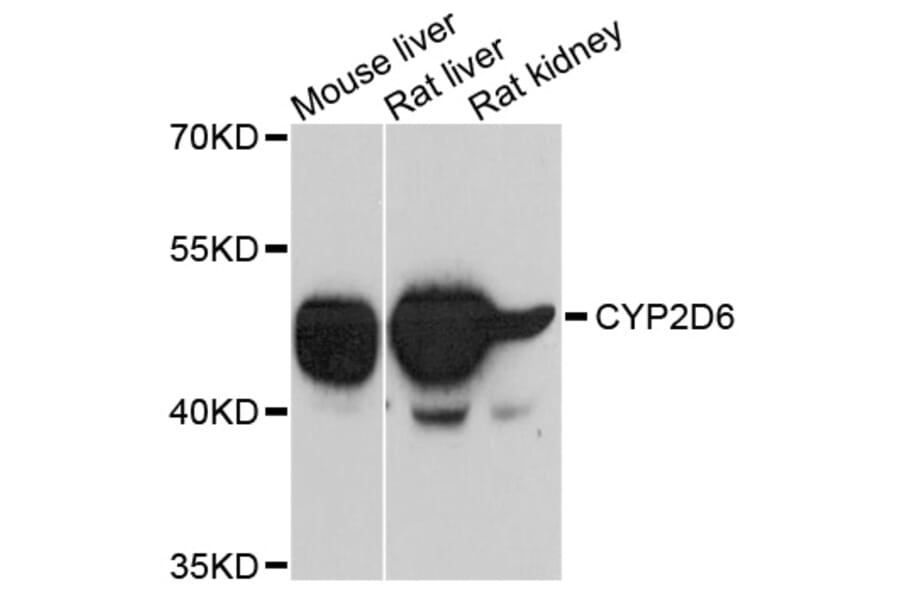 Western Blot - Anti-CYP2D6 Antibody (A10857) - Antibodies.com