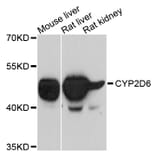 Western Blot - Anti-CYP2D6 Antibody (A10857) - Antibodies.com