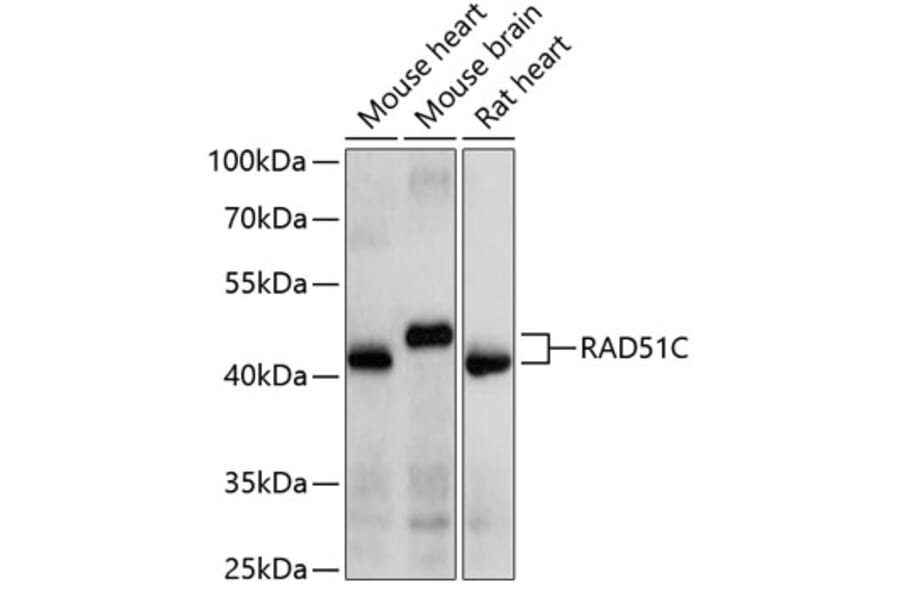 Western Blot - Anti-RAD51C Antibody (A10893) - Antibodies.com