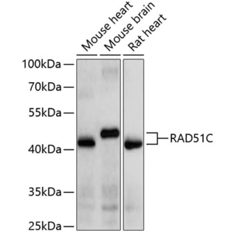 Western Blot - Anti-RAD51C Antibody (A10893) - Antibodies.com