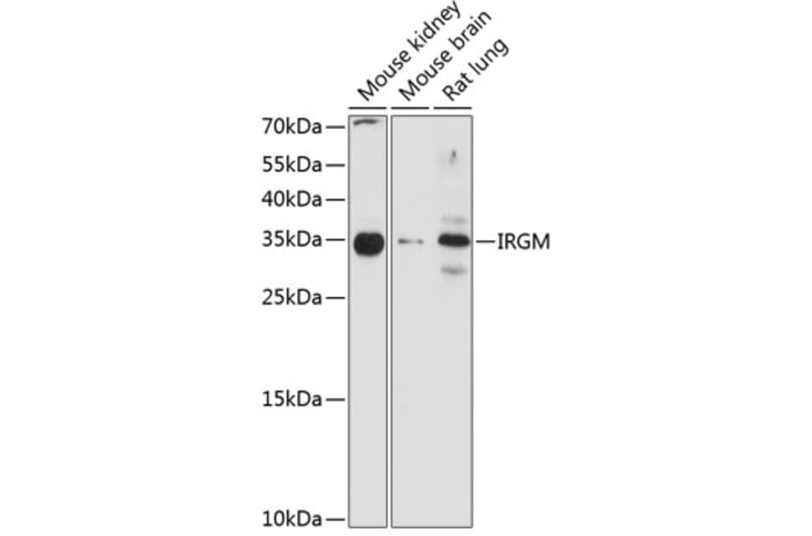 Western Blot - Anti-IRGM Antibody (A10968) - Antibodies.com