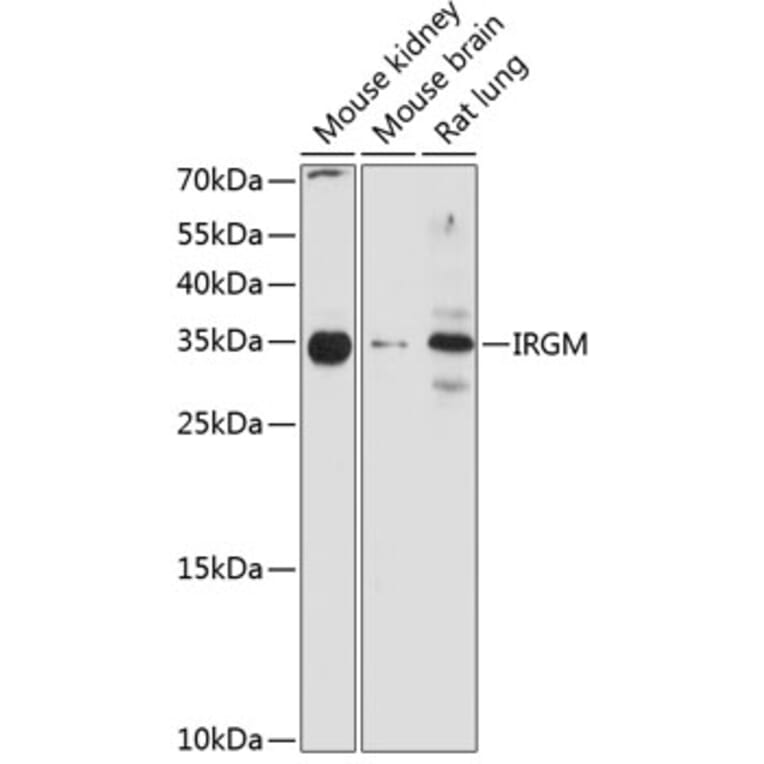 Western Blot - Anti-IRGM Antibody (A10968) - Antibodies.com