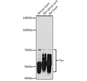 Western Blot - Anti-Tau Antibody (A17182) - Antibodies.com